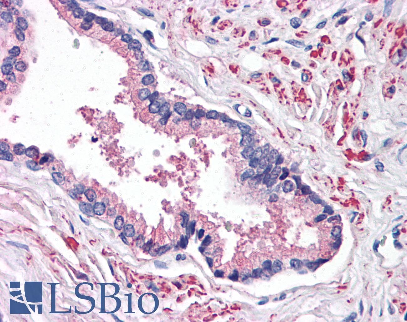 IHC-plus™ STEAP2 Antibody (C-Terminus)