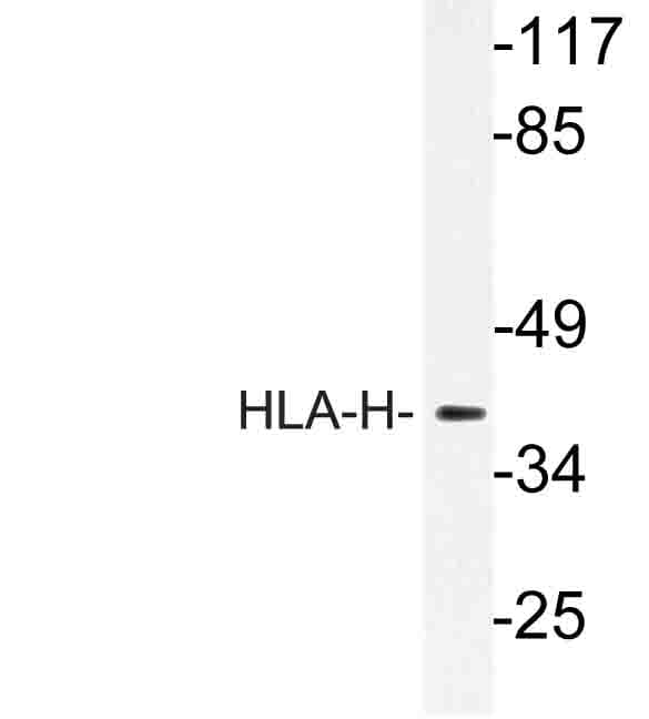 HFE Antibody (Ile104)