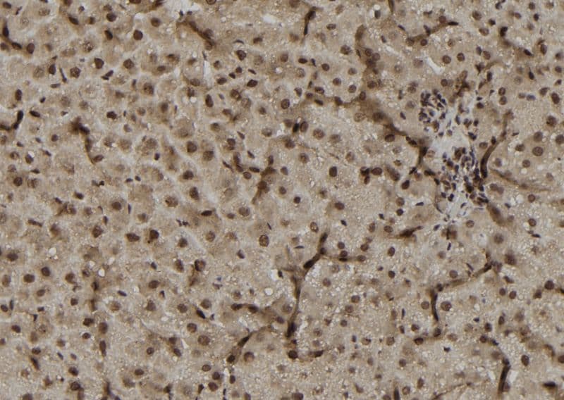 DUSP4 / MKP2 Antibody