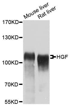 HGF / Hepatocyte Growth Factor Antibody