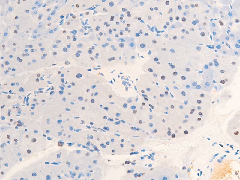 JUN / c-Jun Antibody (phospho-Thr239)