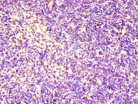 RACGAP1 / MGCRACGAP Antibody