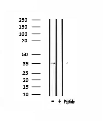 OR5AP2 Antibody