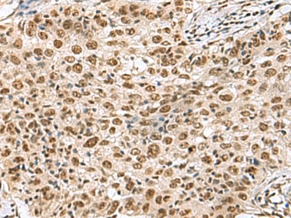 PRPF40A / FNBP3 Antibody