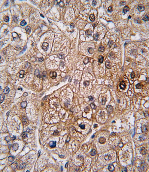 Polyclonal Rabbit anti-Human BMPR2 Antibody (aa28-59, IHC, WB)