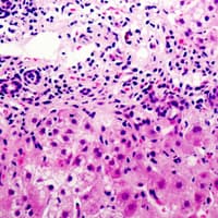CST6 / Cystatin E/M Antibody (Internal)
