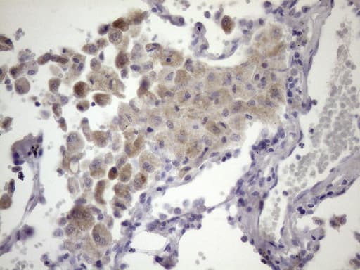 PDIA6 / ERP5 Antibody (clone OTI3E9)