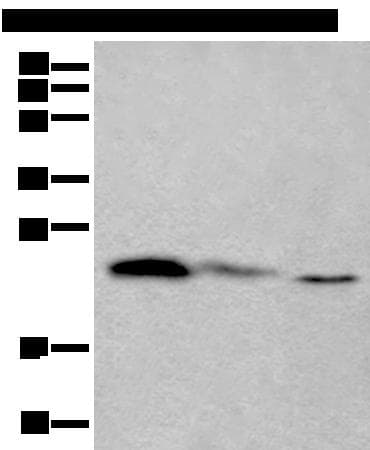TPT1 / TCTP Antibody