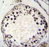 PTCHD3 Antibody (aa689-717)