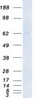 Human PAK4 Protein (Recombinant Myc-DDK (Flag))