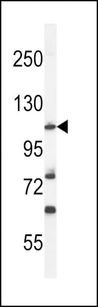 HIF1A / HIF1 Alpha Antibody (aa519-547)