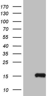 MGP / Matrix Gla-Protein Antibody (clone OTI9C9)