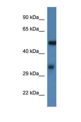FSCN1 / Fascin Antibody (aa93-142)