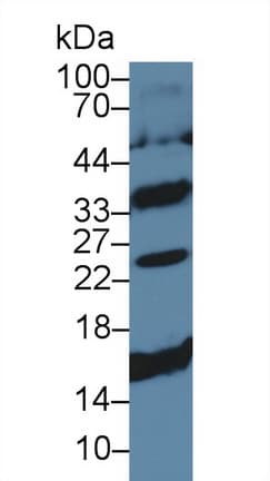 CD79B / CD79 Beta Antibody (aa37-226)
