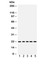 Polyclonal Rabbit anti-Human RAC1 Antibody (WB)