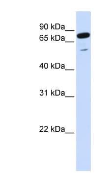 PPP1R13L / iASPP Antibody (aa756-805)