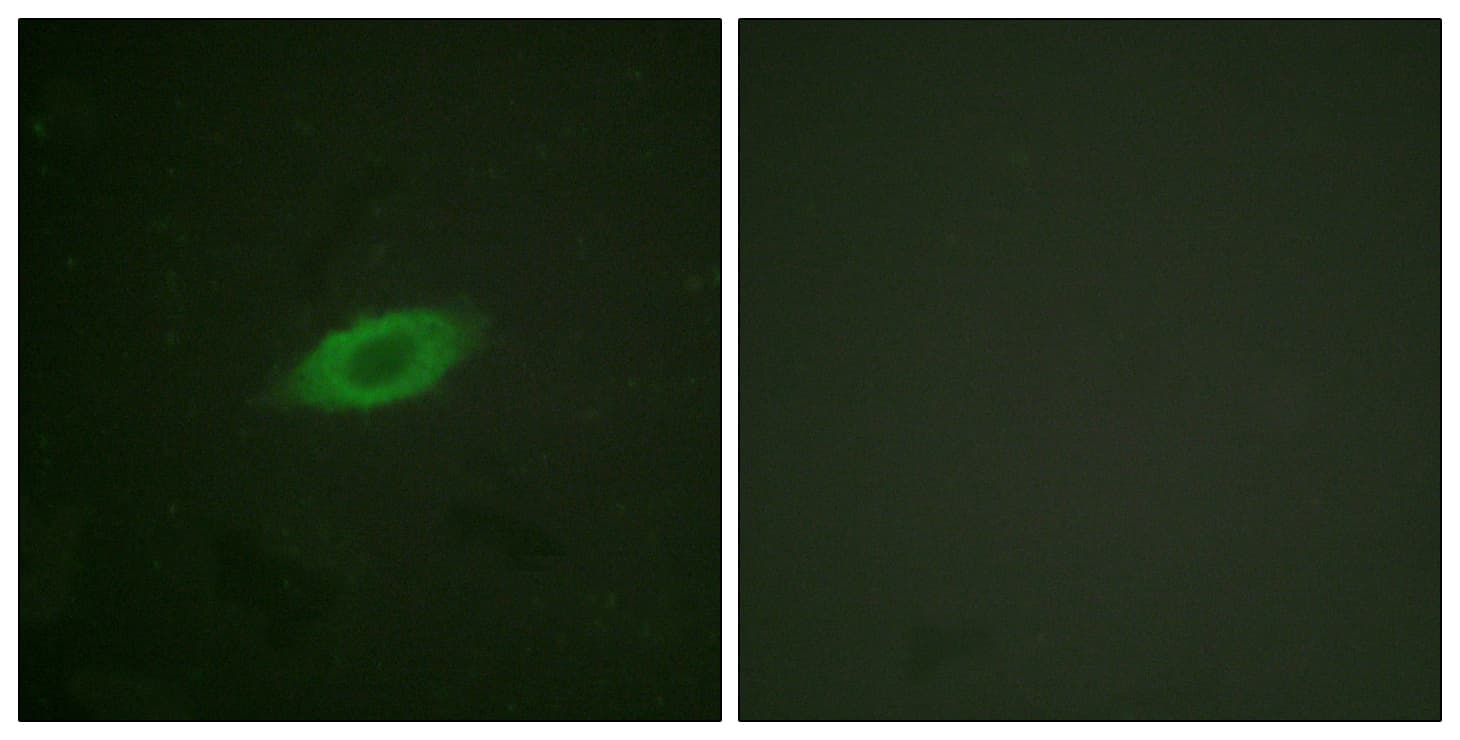 IHC-plus™ ANXA6/Annexin A6/Annexin VI Antibody (aa1-50)
