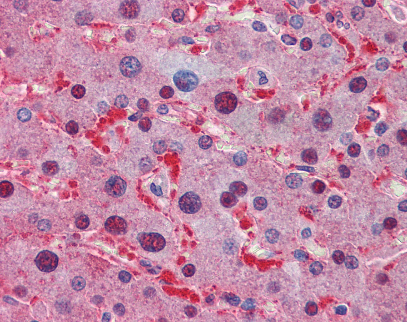 Polyclonal Rabbit anti-Human LDHA / LDH1 Antibody (N-Terminus, IHC, WB)