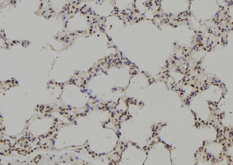 PTPN6 / SHP1 Antibody
