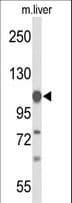 Polyclonal Rabbit anti-Human GLDC Antibody (aa49-77, WB)