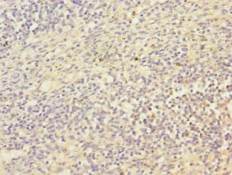 Polyclonal Rabbit anti-Human MCM10 Antibody (IHC)