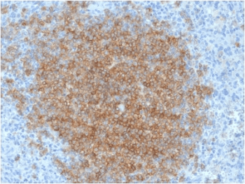 CD79B / CD79 Beta Antibody (clone IGB/1844)