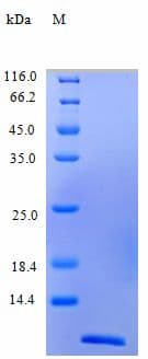 Human CCL24 / Eotaxin 2 Protein (Recombinant)