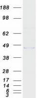 Human MMAA Protein (Recombinant Myc-DDK (Flag))