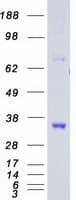 Human CDK5 Protein (Recombinant Myc-DDK (Flag))
