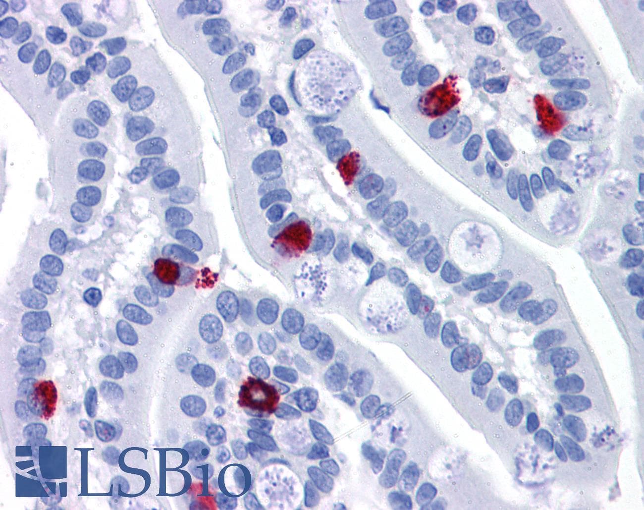 IHC-plus™ GCC2 Antibody (aa1174-1185)