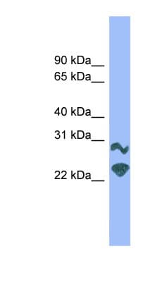 DRGX Antibody (aa151-200)