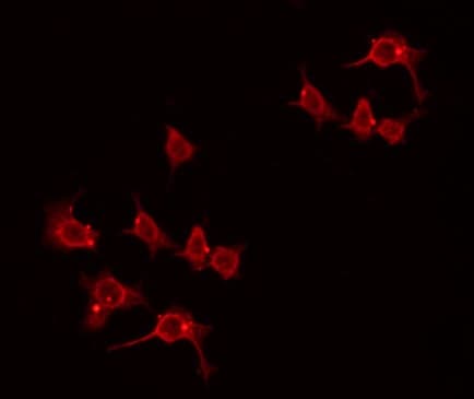 DAT1 / LMO3 Antibody