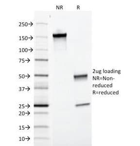 CD74 / CLIP Antibody (clone SPM523, Azide-free, BSA-free)