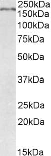 IHC-plus™ Polyclonal Goat anti-Mouse ROBO1 Antibody (aa1417-1428, IHC, WB)