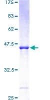 Human ARL5A / ARL5 Protein (Recombinant GST)