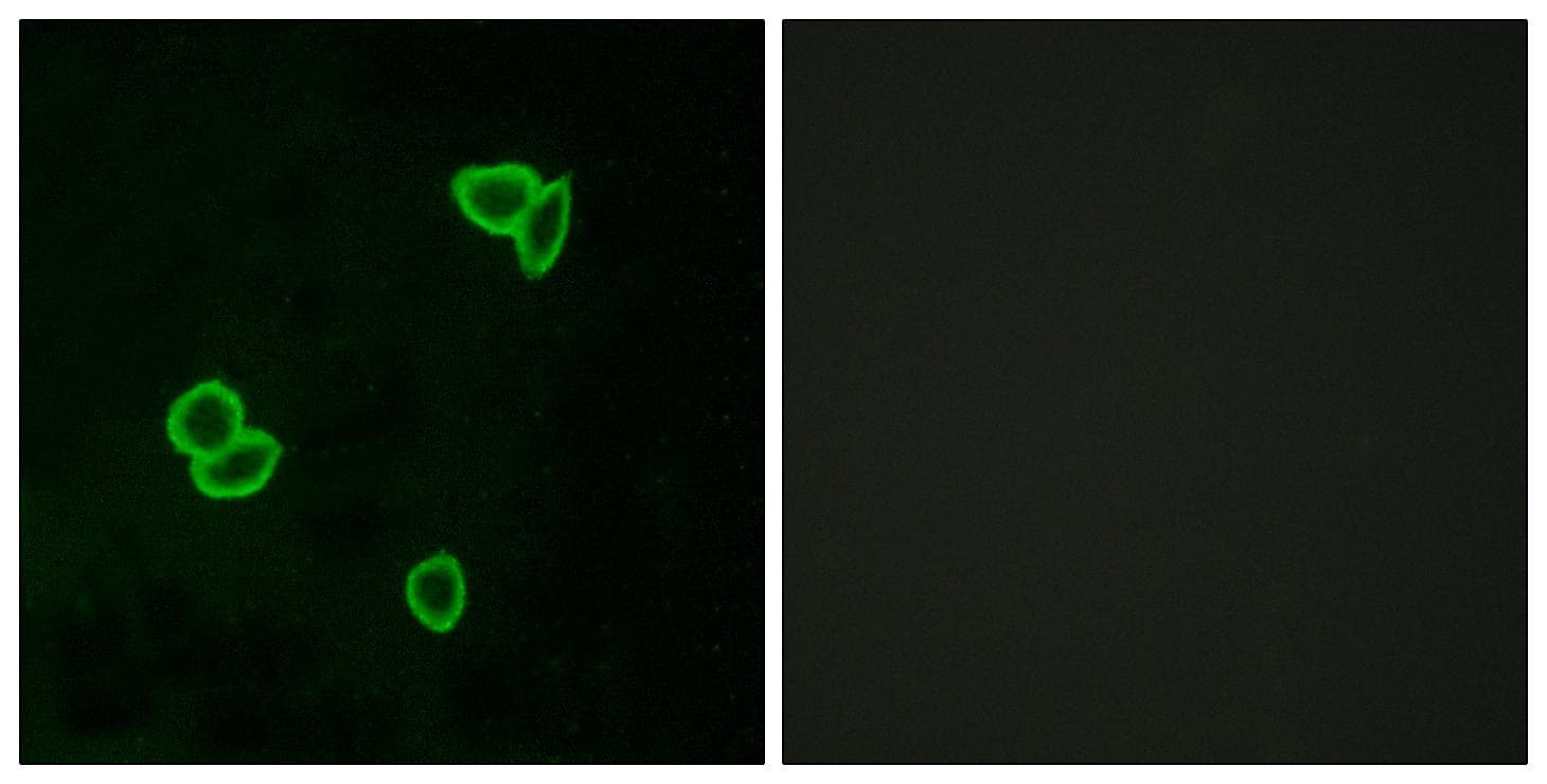 ADGRL1 / LPHN1 Antibody