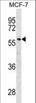 GBA / Glucosidase Beta Acid Antibody (aa337-365)