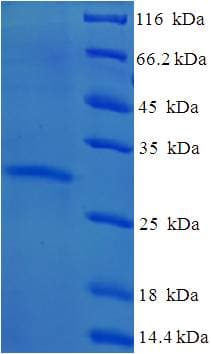 Human YPEL3 Protein (Recombinant His-SUMO)