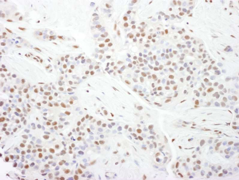 CDK9 Antibody (aa322-372)
