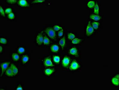 HK2 / Hexokinase 2 Antibody