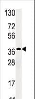 RBKS / Ribokinase Antibody (aa16-46)