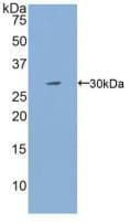 IL2RG / CD132 Antibody (aa23-262, Cy3)