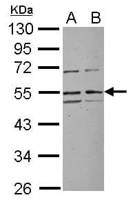 Polyclonal Rabbit anti-Human RRP1 Antibody (Internal, WB)