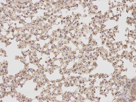 PTPN2 / TC-PTP Antibody