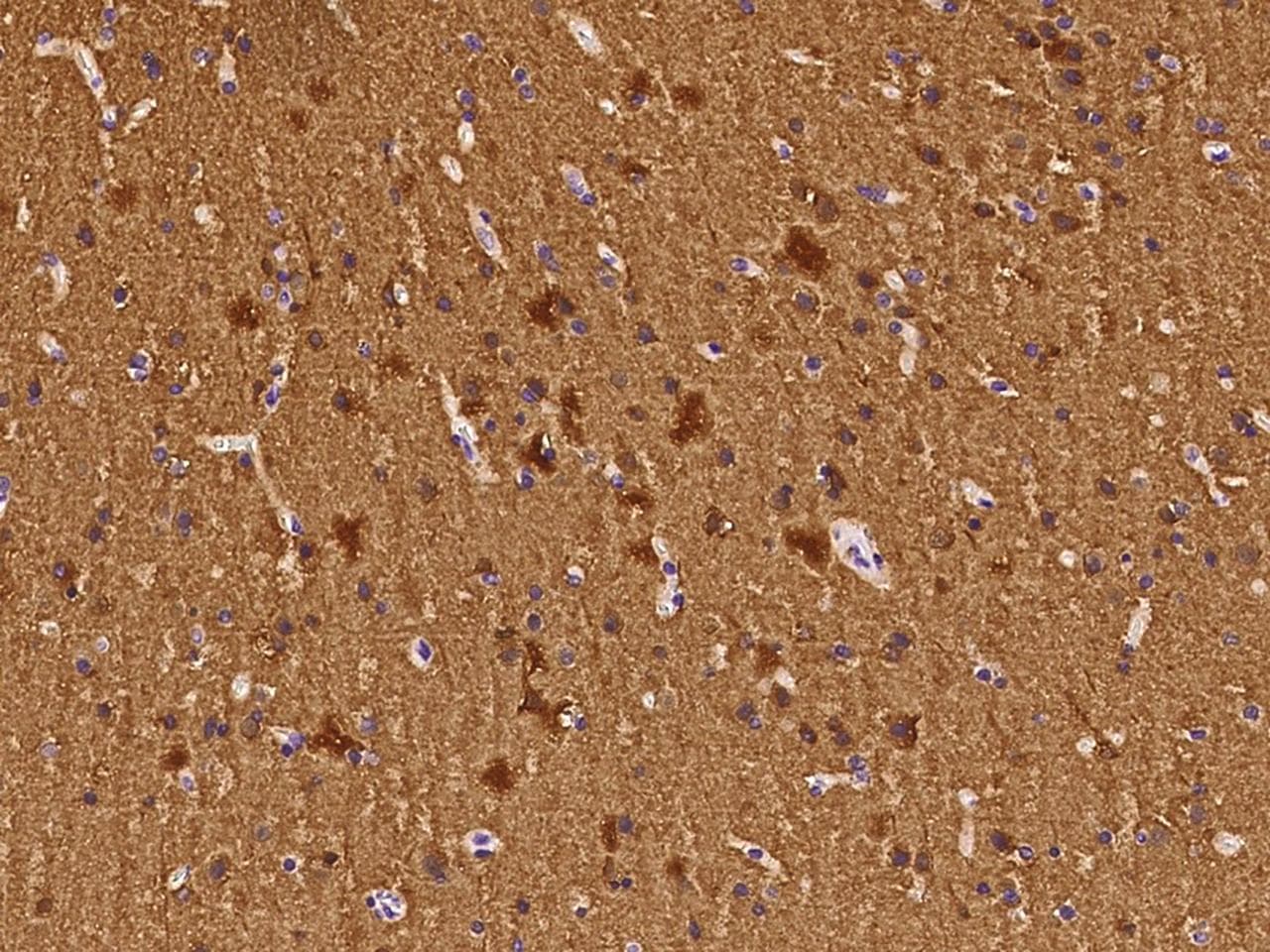 Monoclonal Mouse anti-Human ENO2 / NSE Antibody (clone 14, Preservative Free, IHC, WB)