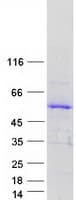 Human TSPYL5 Protein (Recombinant Myc-DDK (Flag))