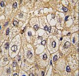 Polyclonal Rabbit anti-Human EPHA7 / EPH Receptor A7 Antibody (IHC, WB)