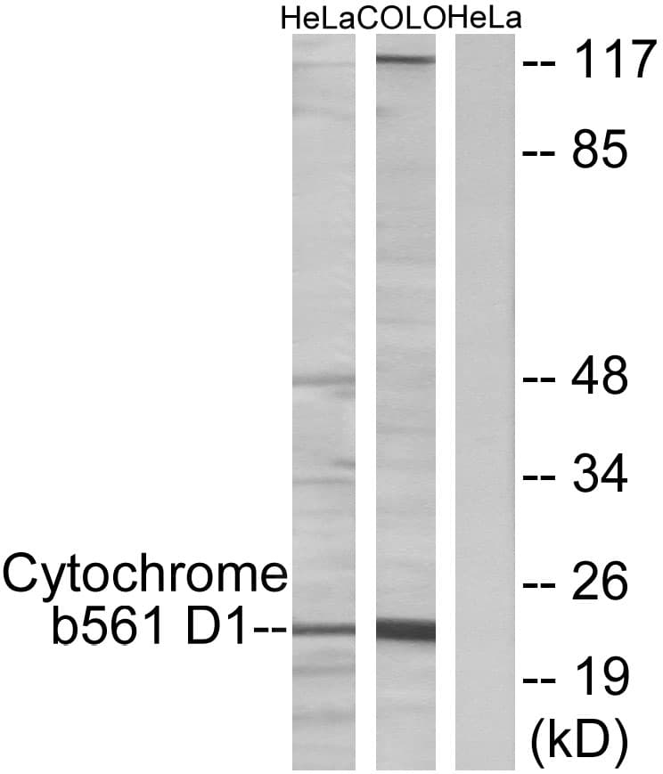 CYB561D1 Antibody (aa180-229)