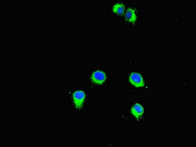 SMYD2 Antibody