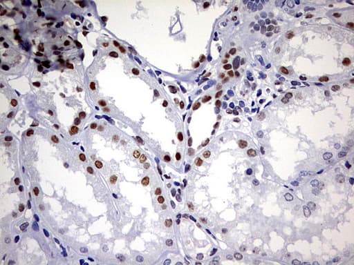 DDX56 Antibody (aa323-547, clone OTI5C1)